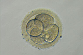 Time-Lapse Embryobeobachtung